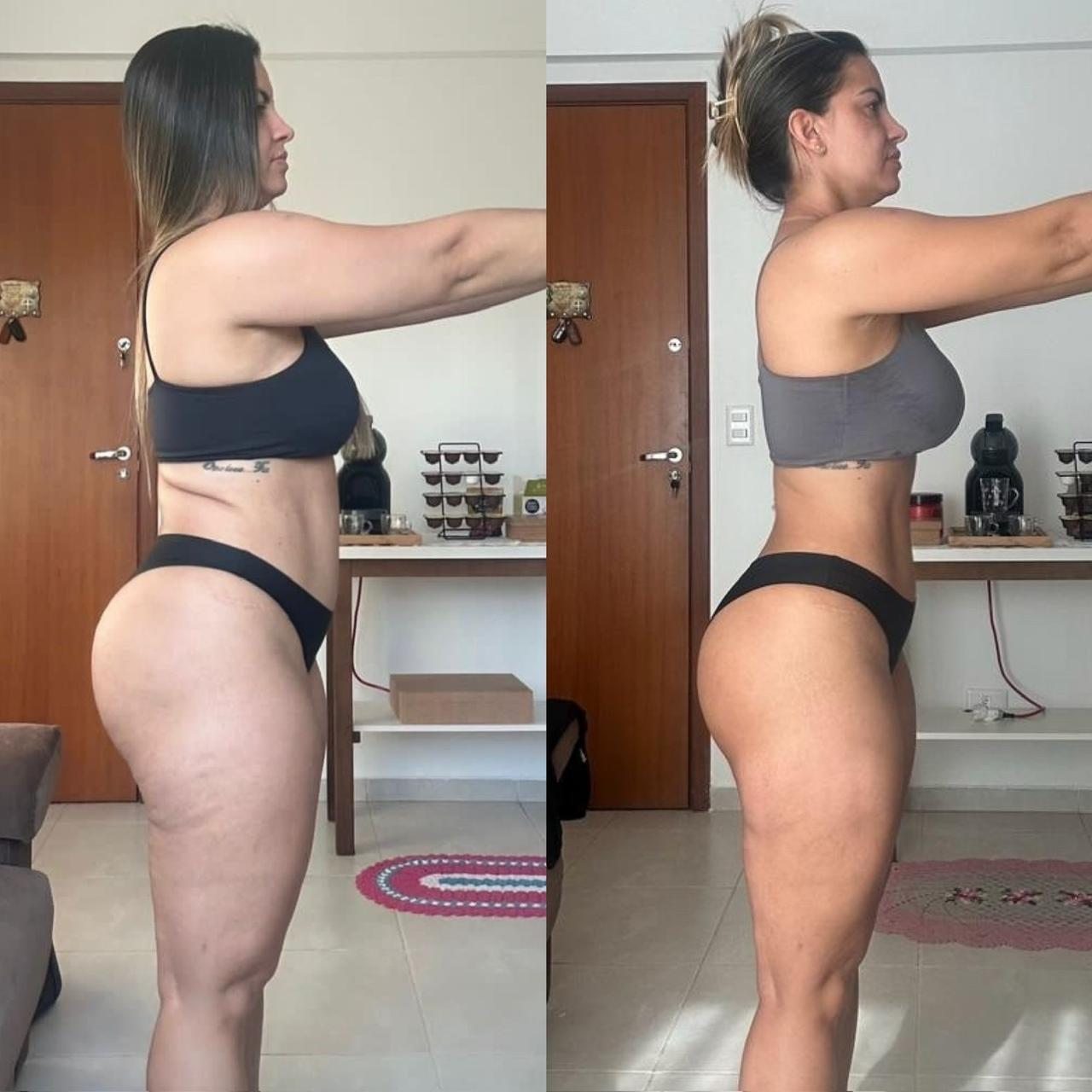 Antes e depois 3