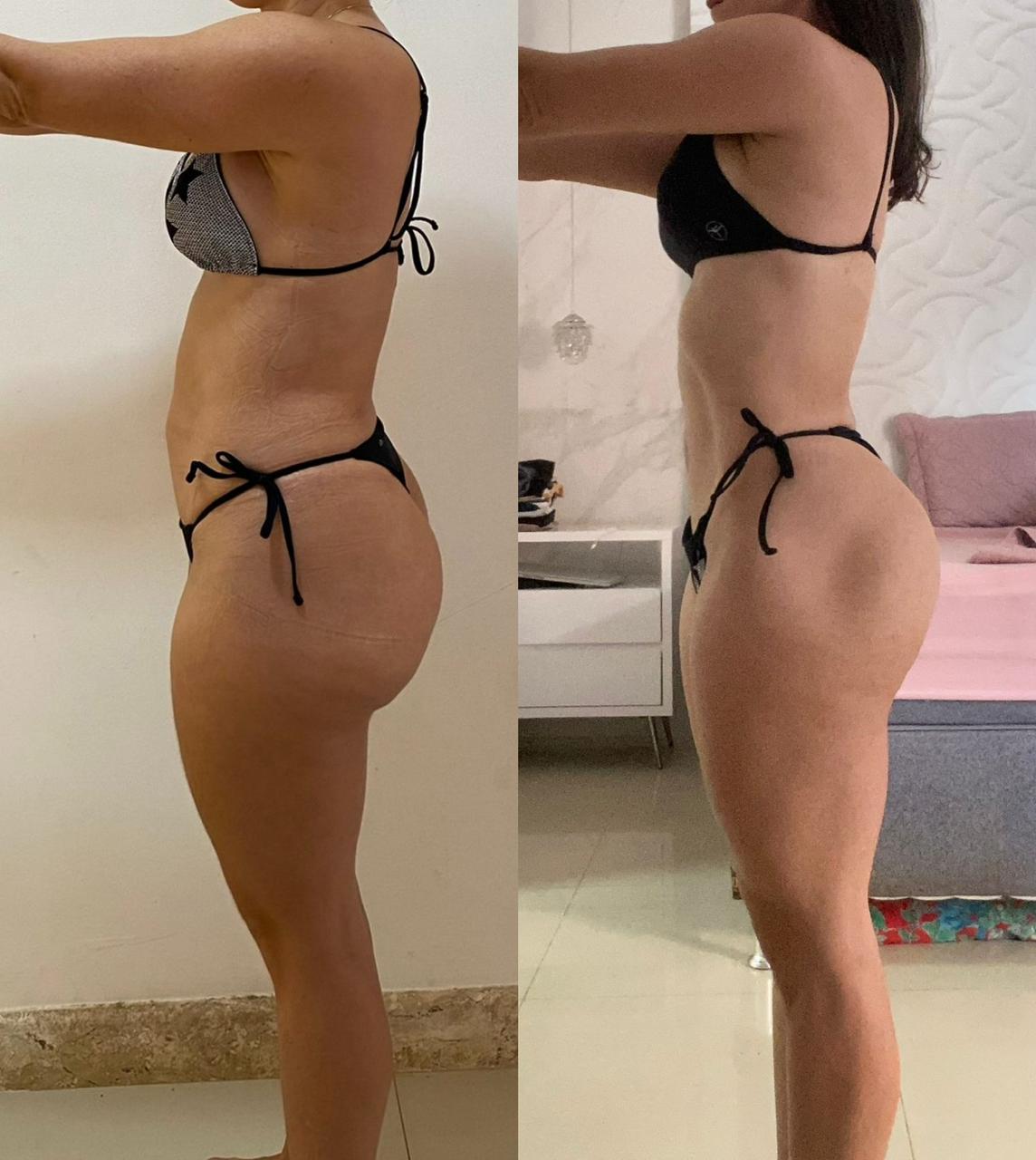 Antes e depois 4