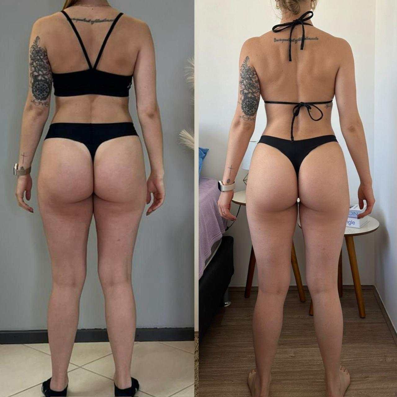 Antes e depois 6