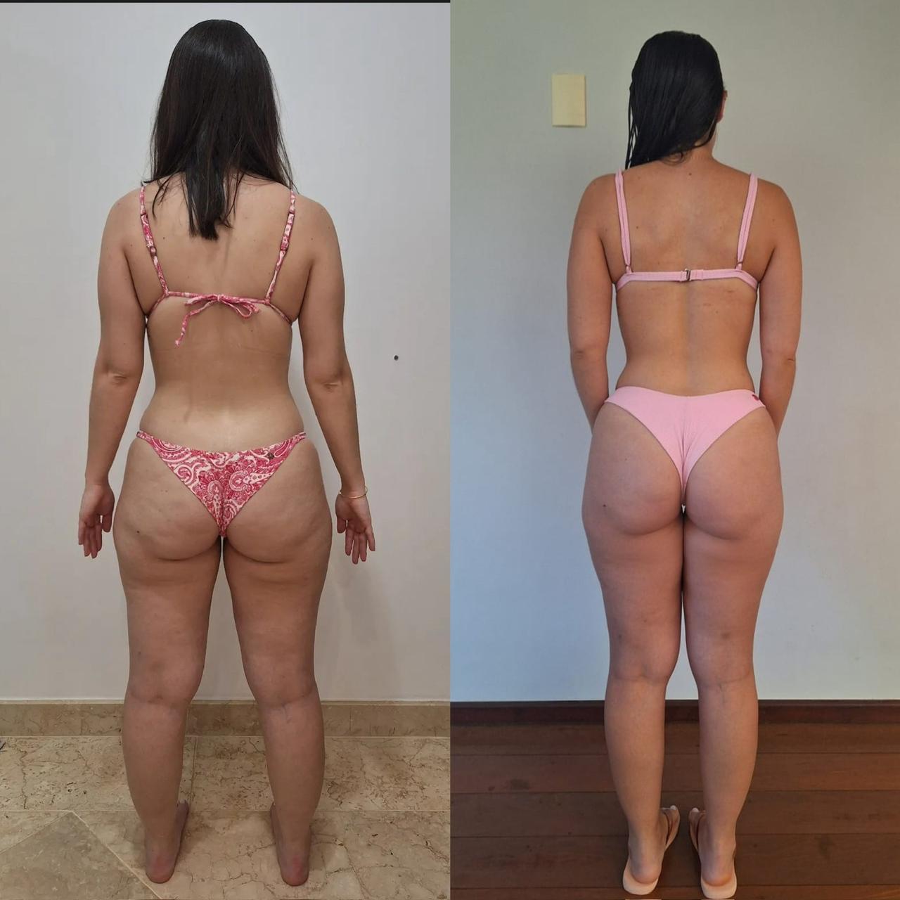 Antes e depois 7